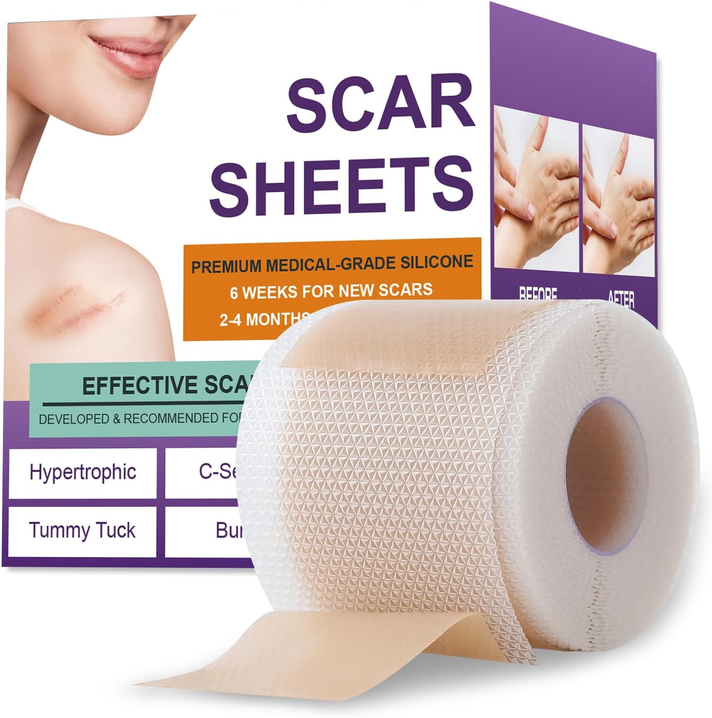 Psecici Silicone Scar Tape for Surgical Scars,Extra Long Scar Sheets for C-Section, Tummy Tuck