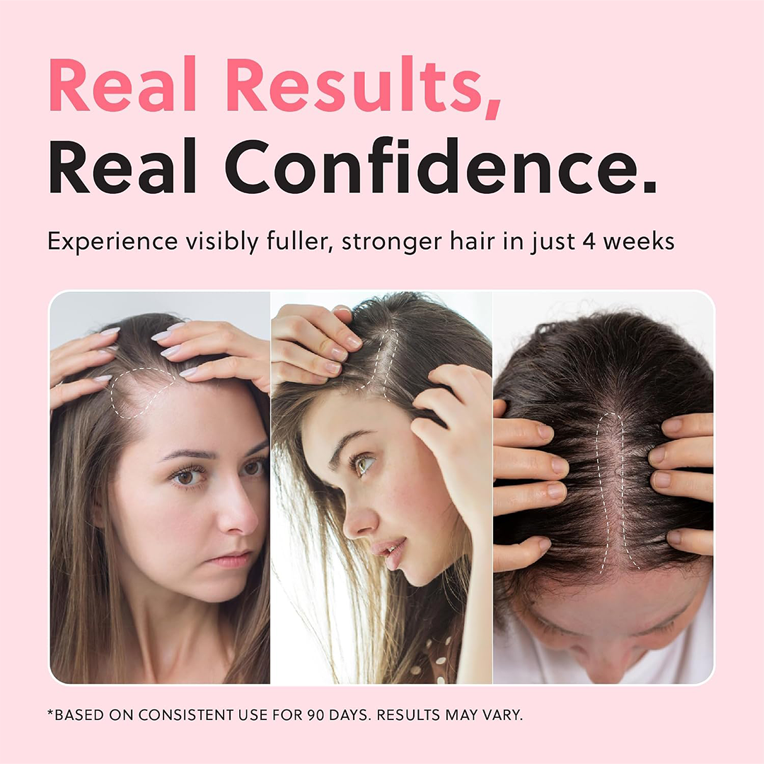 Hair Growth Oil Spray, Advanced Hair Growth Oil for Promoting Thicker Natural Hair, Damage Repair & Loss Prevention, Non-Greasy & Hormone-Free Formula, Ideal for Dry Scalp