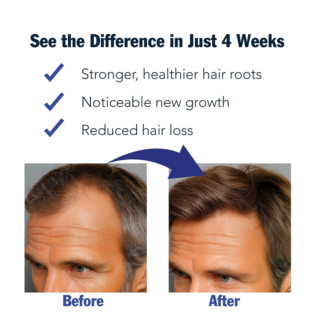 Puggaree Redensyl Hair Growth Serum Roll-On with 3% Redensyl & Rosemary 30ml