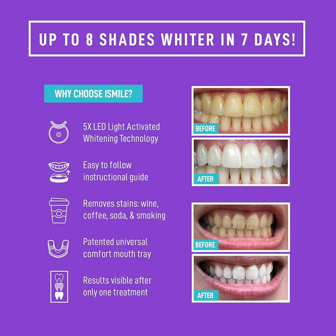 iSmile LED Light Teeth Whitening Kit Complete Home Whitening System