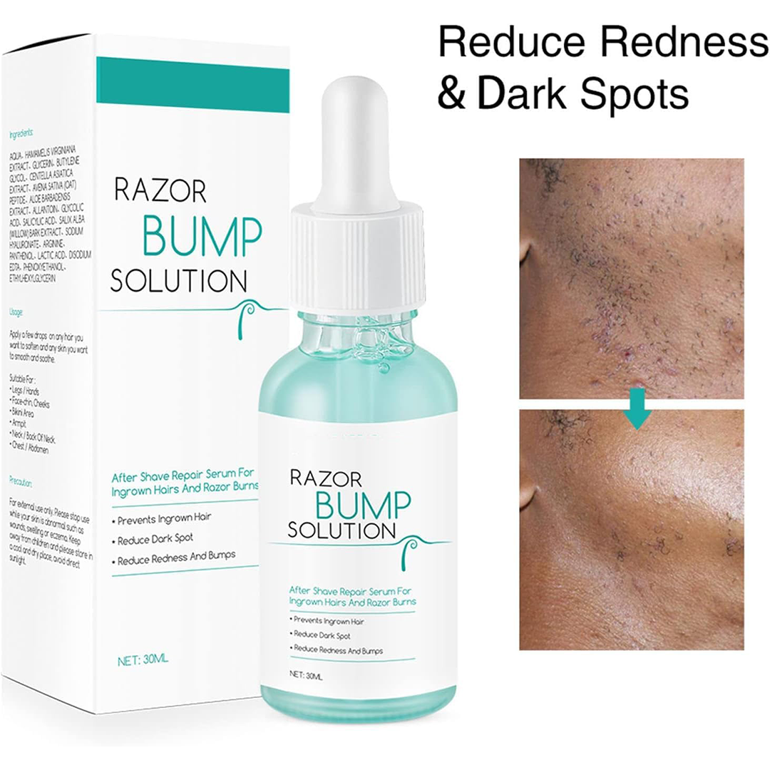 Razor Bump Solution, 30ml Razor Bump Solution Prevent Ingrown Hair Mild Moisturizing Shave Repair