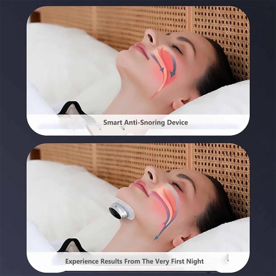 NALACAL Smart Throat Anti-Snoring Device Electric Massage Anti-Snoring & Sleep Apnea Support