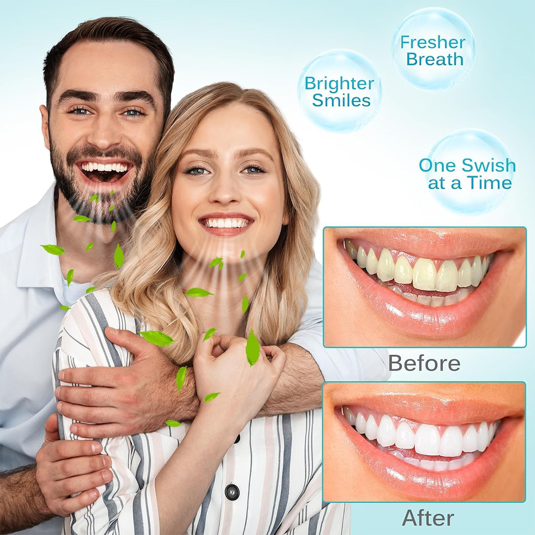 ALIVER Coconut Pulling Oil Sachets for Teeth Whitening – 30 Alcohol-Free Oral Care Packs