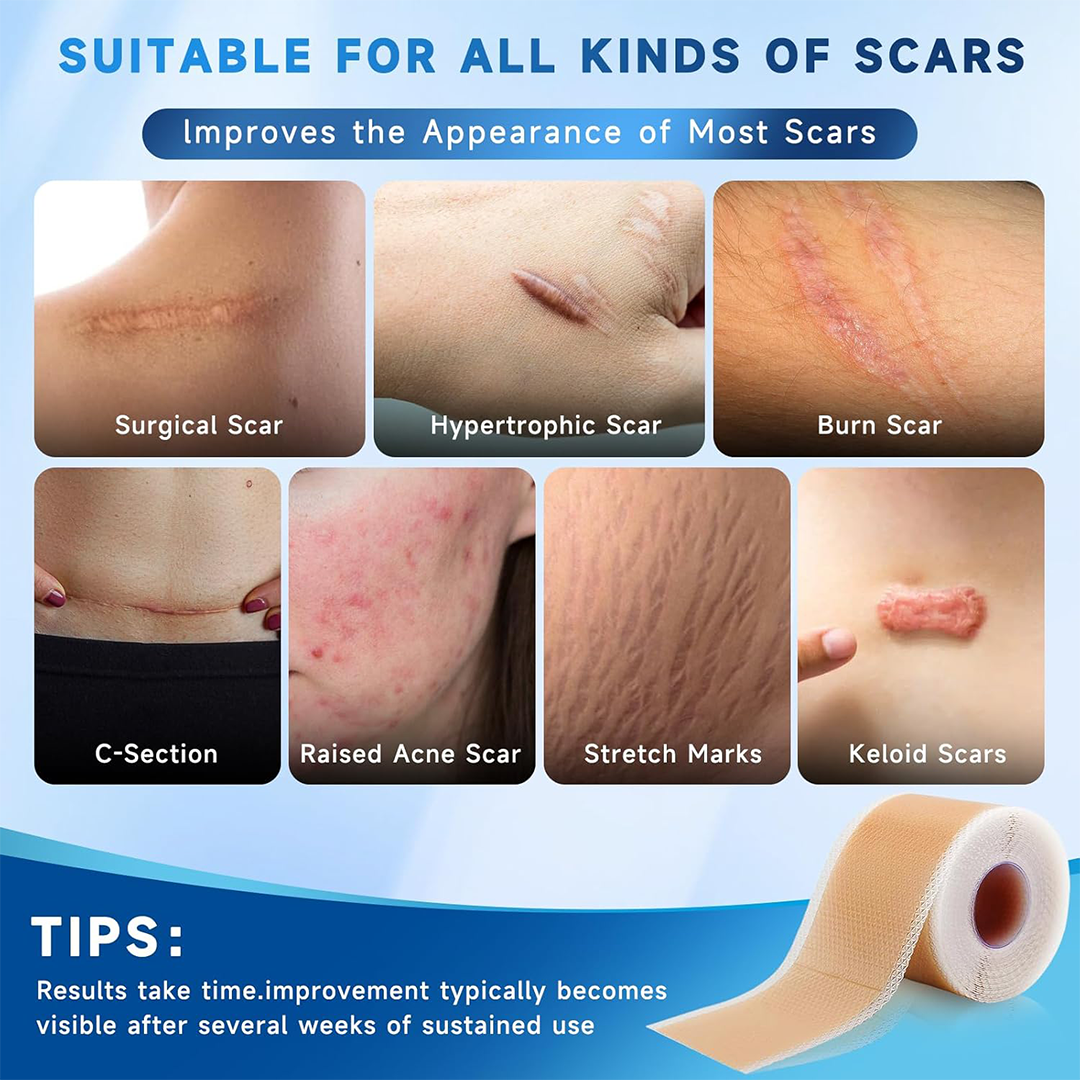 RVLAIM Medical Grade Silicone Scar Tape Roll 1.8 Inch x 157 Inch Reusable Waterproof Scar Sheets