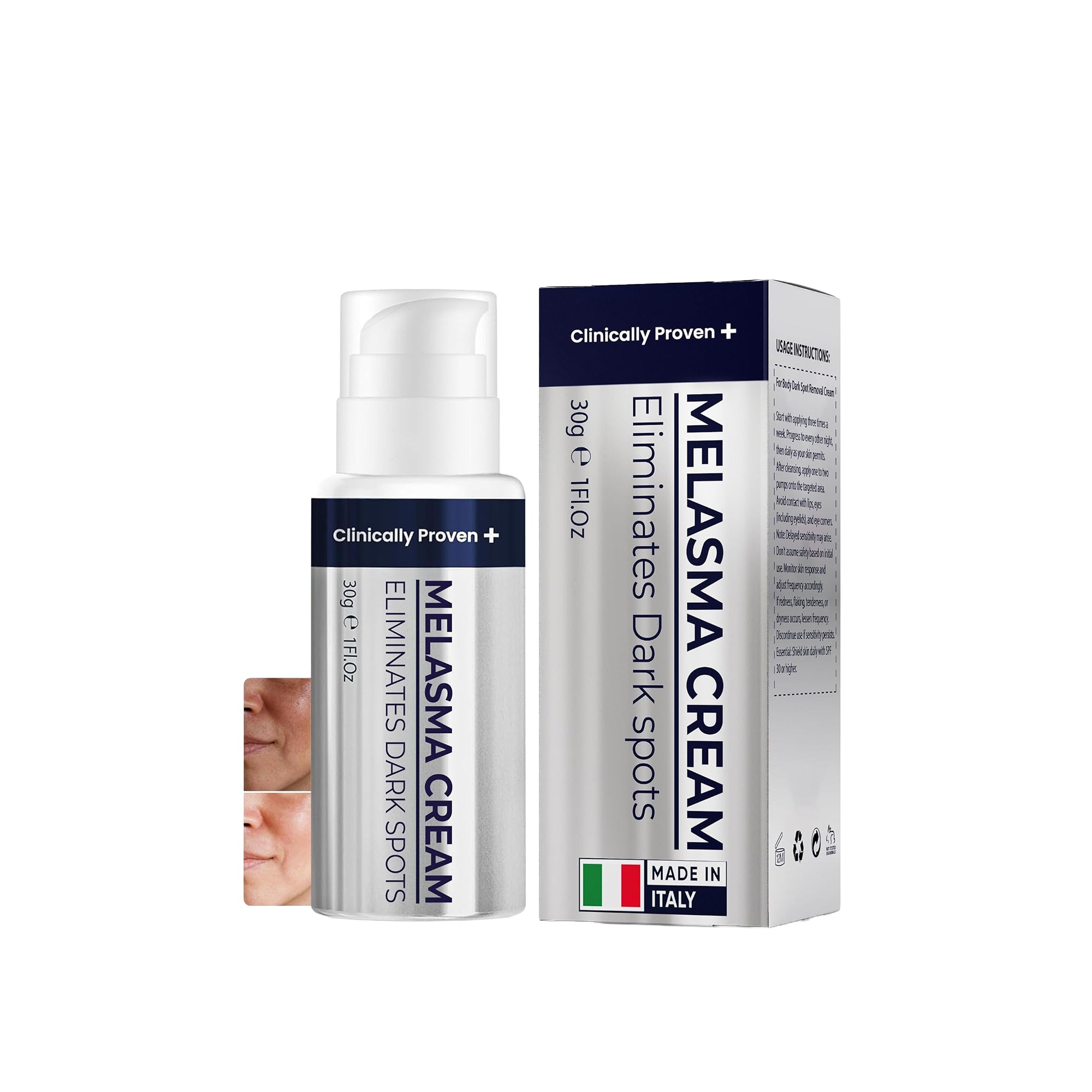 Clinically Proven+ Melasma Cream – Dark Spot & Age Spot Remover for Skin Discoloration, Scars & Post-Blemish Marks (30g)