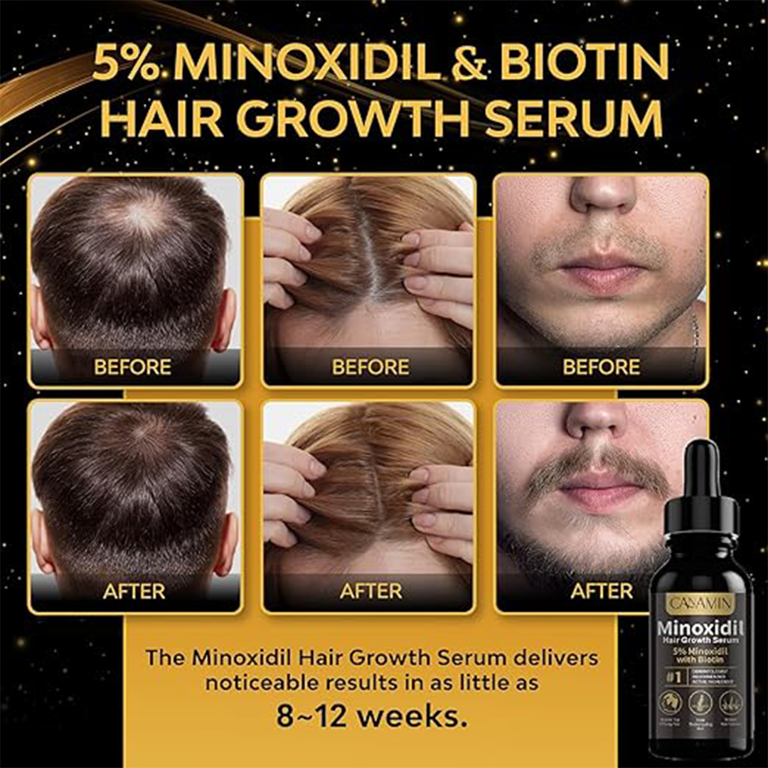5% Minoxidil Hair Growth Serum for Men and Women, Hair Regrowth Treatment for Stronger, Thicker, and Longer Hair, Facial Hair Grooming and Thickening Solution